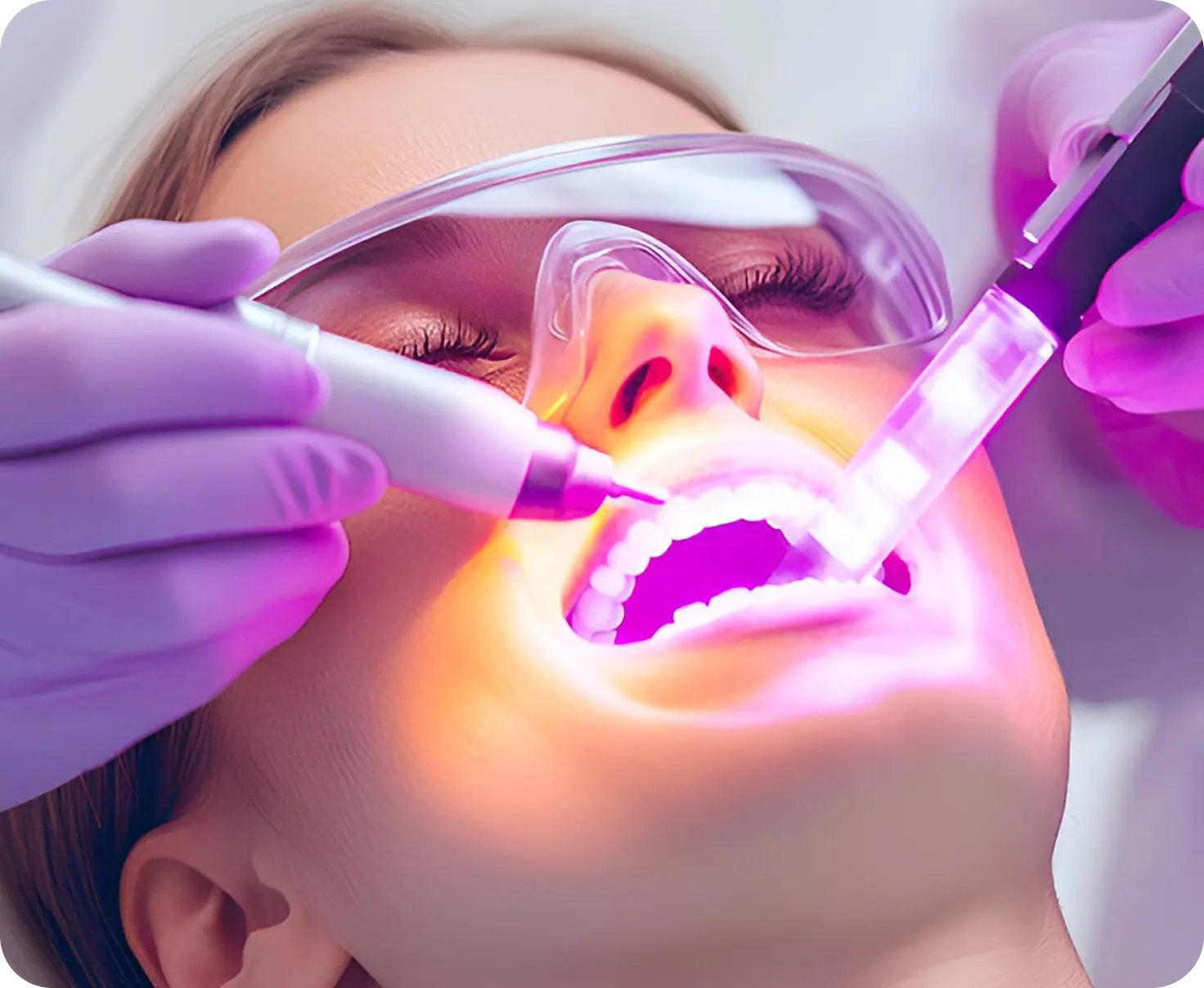 Laser Treatments